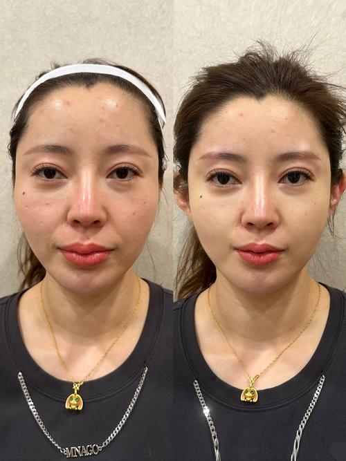 美容仪器长期用真的能抗老吗?五年真实体验-我问答网