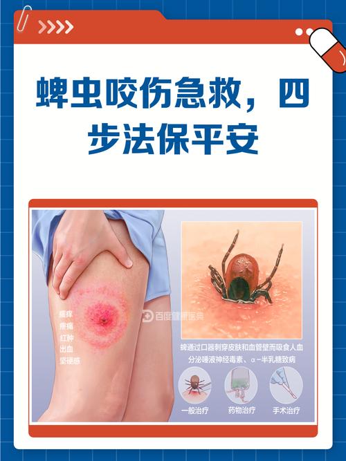 蜱虫叮咬皮肤和正确拔除方法示意图