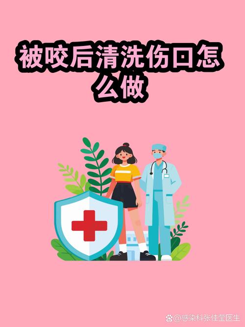 儿童被宠物咬伤后家长帮着冲洗伤口示意图