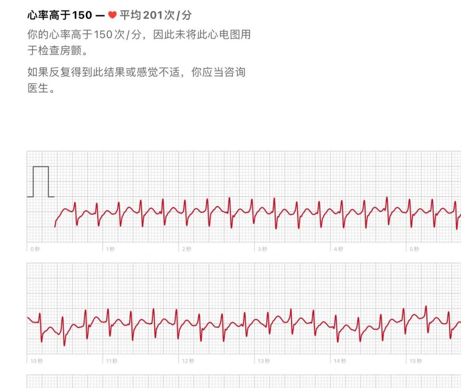 服务发现心跳检查雪崩效应曲线图