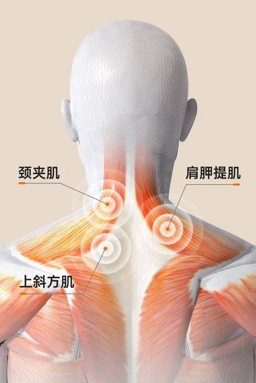 办公室伏案肩颈紧张肌肉示意图