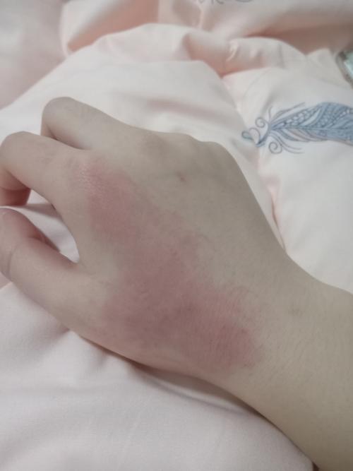 必须立刻就医的睡眠倒退期红线