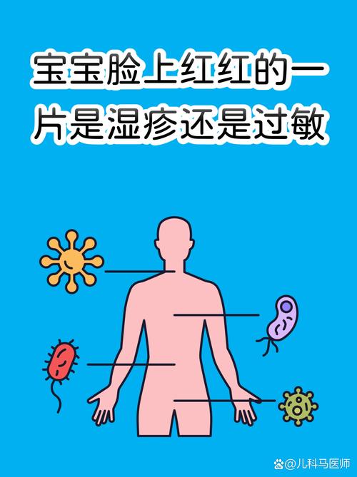 ❓ 过敏宝宝，这些问题的答案你一定想知道