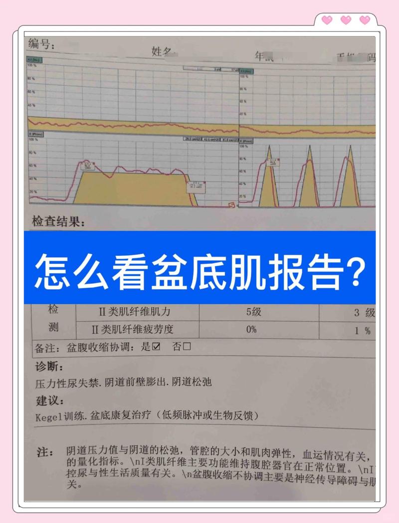 顺产后42天盆底肌功能复查评估图