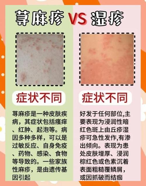 二、三步走：把过敏史管理落到实处