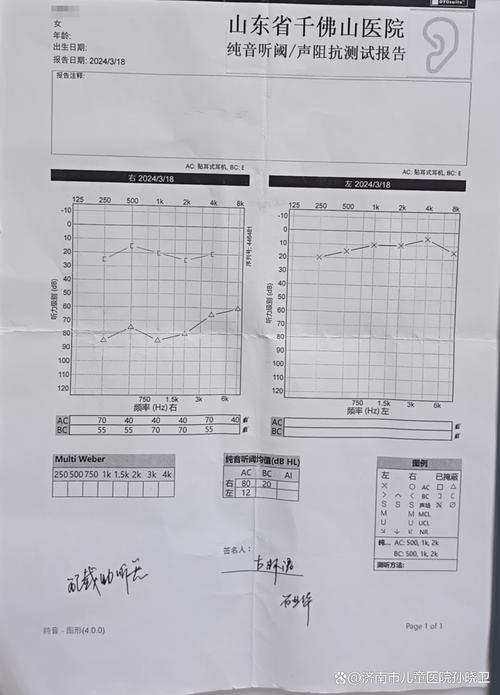 隔音窗关闭前后噪音计实测数据对比柱状图