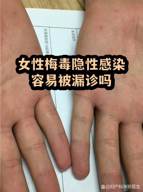 那些容易被漏查的暗病