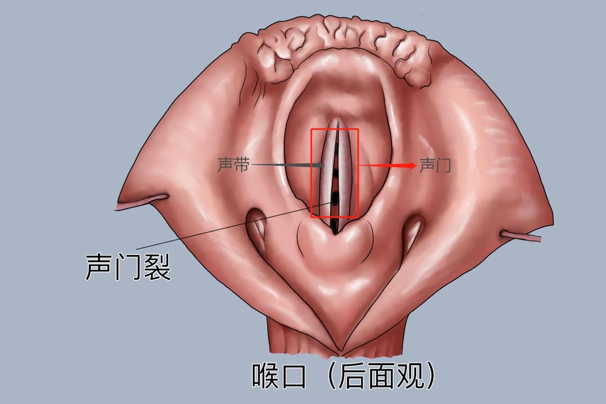 歌手高音发声喉咙内部剖面示意图