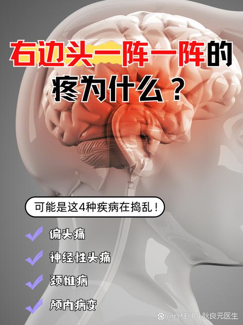 那些让人头疼的日常故障