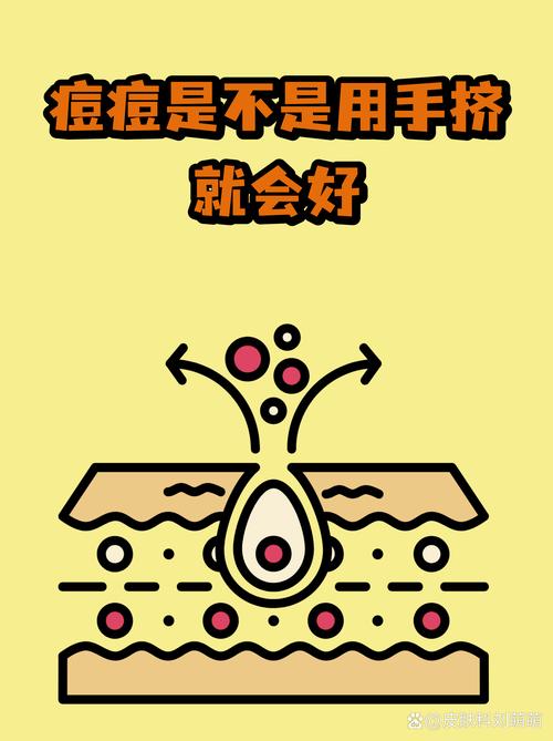 那些关于工业挤压的常见误区