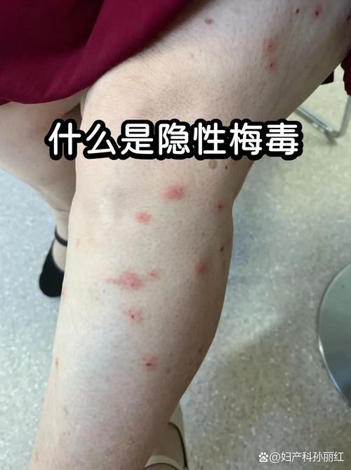 容易被忽略的隐性影响
