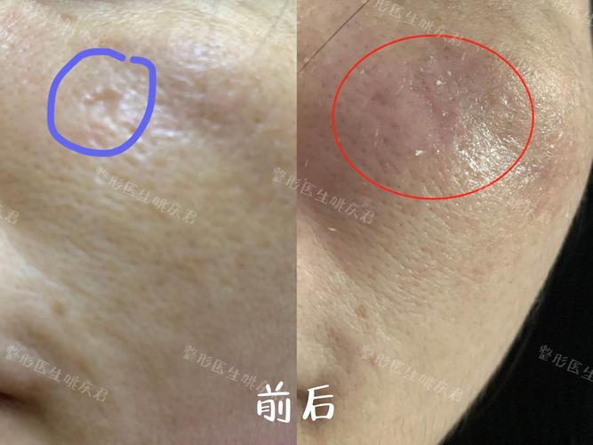 那些年遇到的坑:水刀切割常见的几个“真问题”