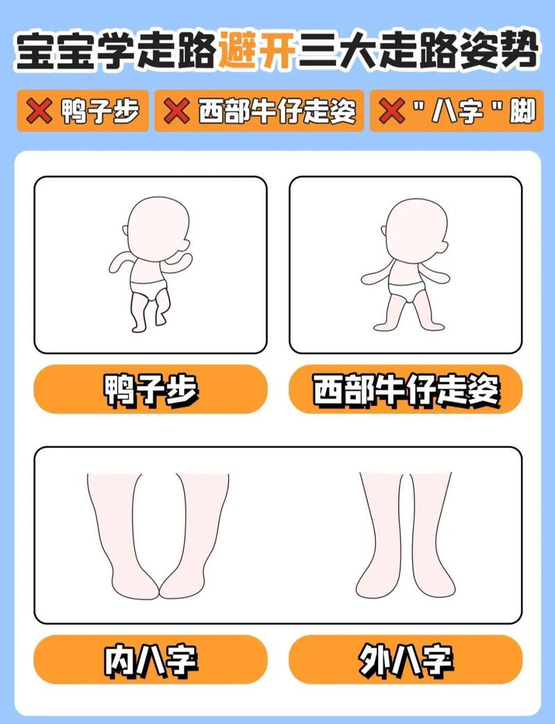 哪些宝宝学步异常必须马上就医