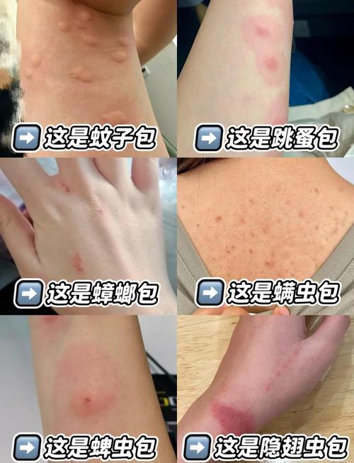 被扰被咬之后,证据要留对