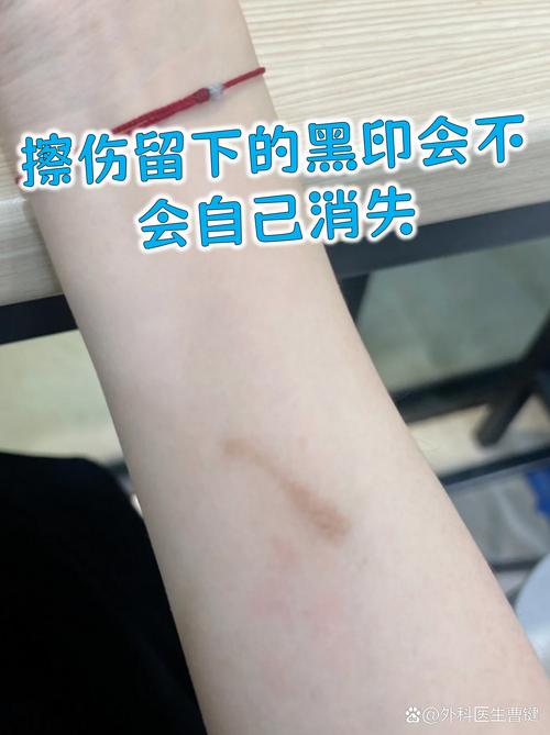 擦不干净的印子