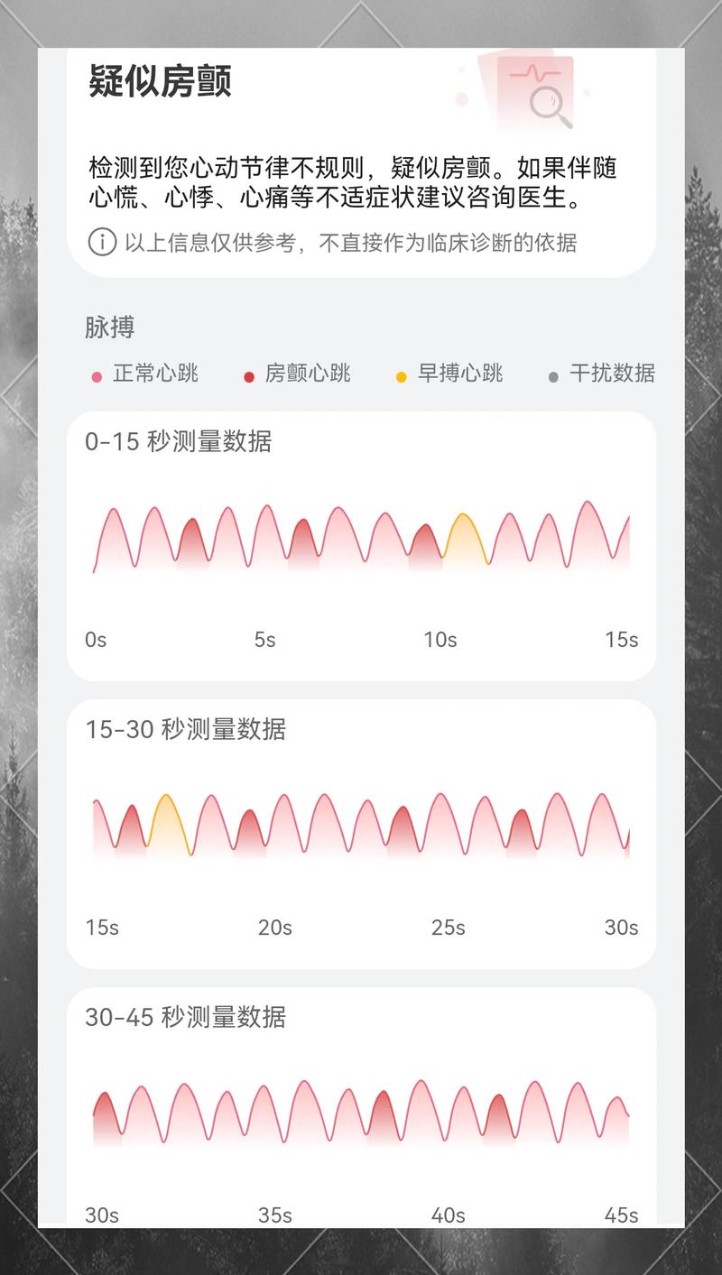 运动时智能手表心率监测延迟对比图