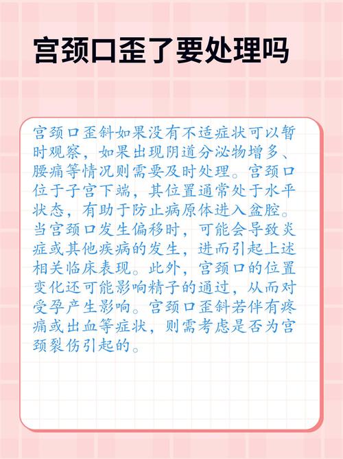 调完没多久又歪？多半是你漏查了这个地方