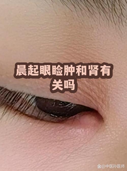 早晨起床眼睑浮肿前后对比图