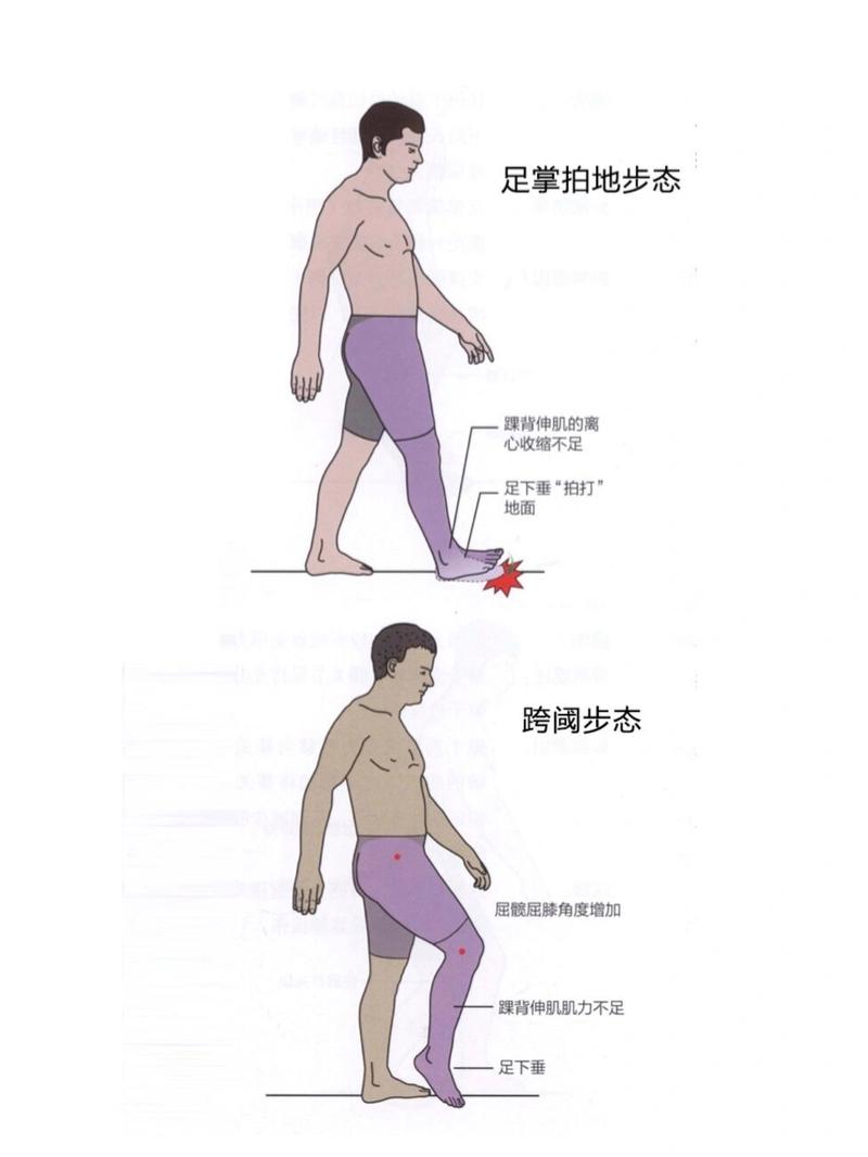 走路步态与口袋负重关系图解