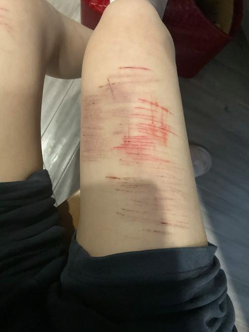 不能硬扛的产后护肤就医红线