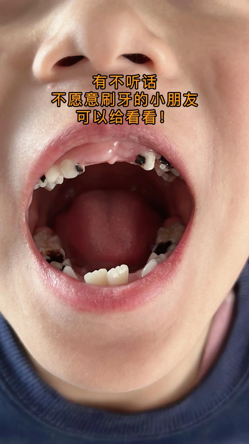 儿童自主刷牙不情愿表情特写