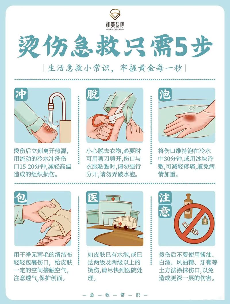 家庭烫伤冷水冲洗处理步骤图