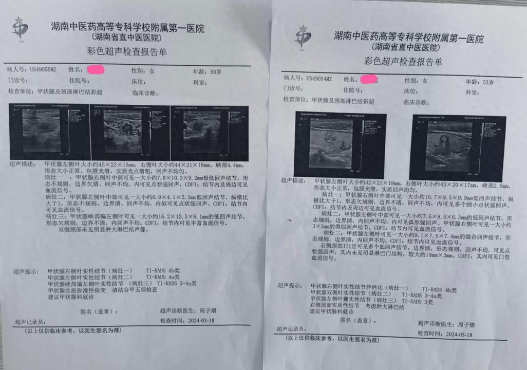 甲状腺结节超声检查体检报告单