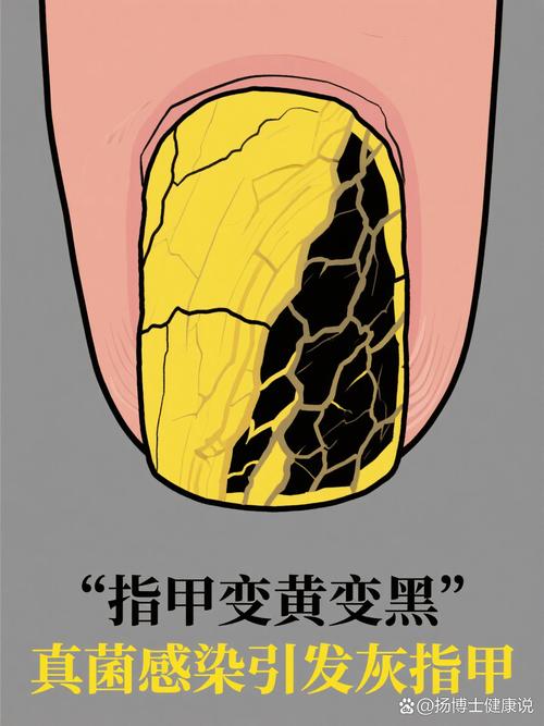 容易踩坑的模糊问题