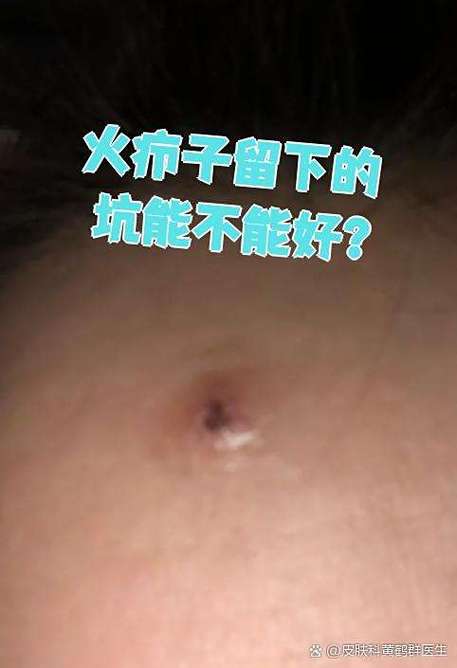 爆火背后，藏着哪些看不见的坑