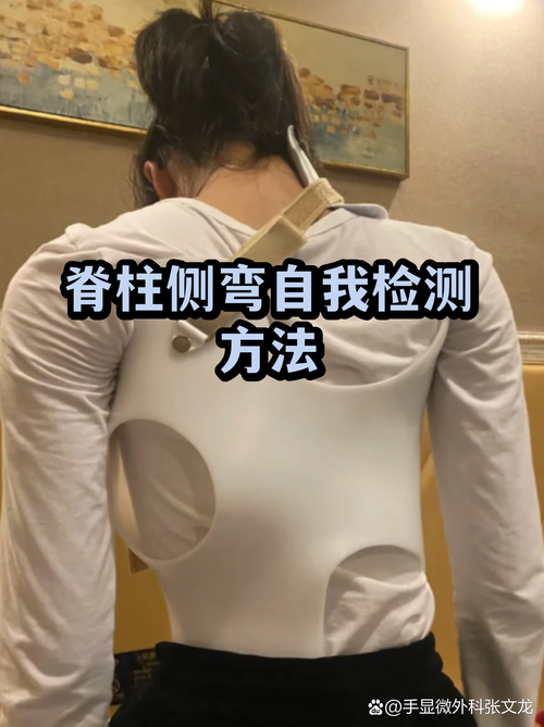 青少年脊柱侧弯弯腰检查示范图