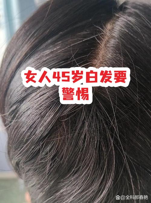 后来我才发现,白头发根本不是什么“衰老判决书”