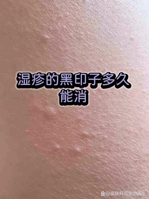 刷完就不管的话，过半个月黑印子还会回来