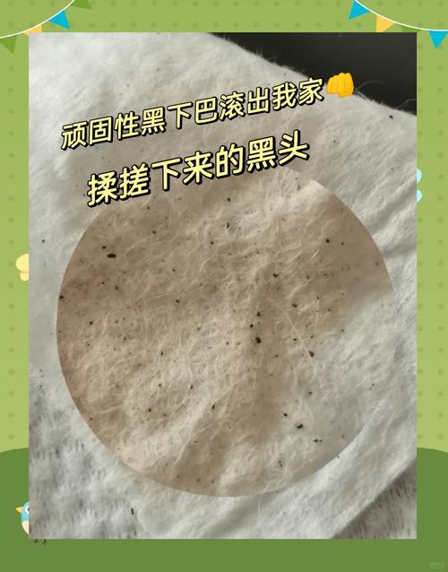 想让黑下巴不反复，做好这三件小事