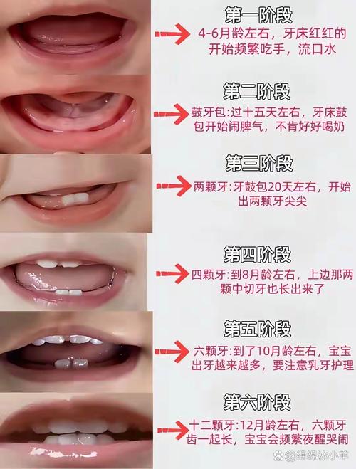 不能拖的宝宝出牙不适就医红线