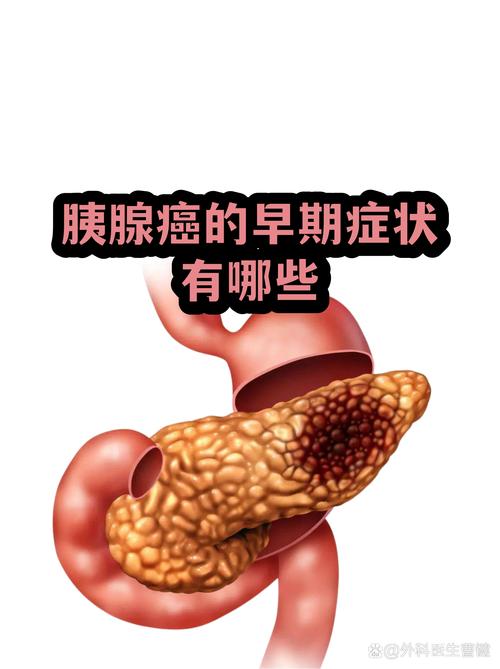 容易被忽略的关键问题