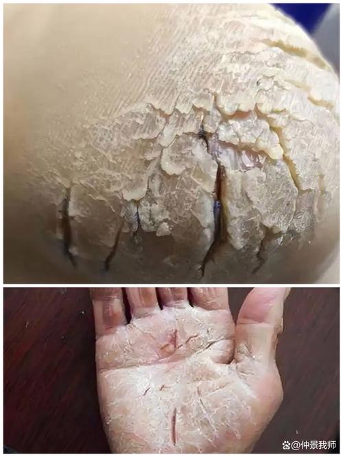 关于手印脚印，这些坑你一定踩过！工业级选购秘辛-超级宝贝