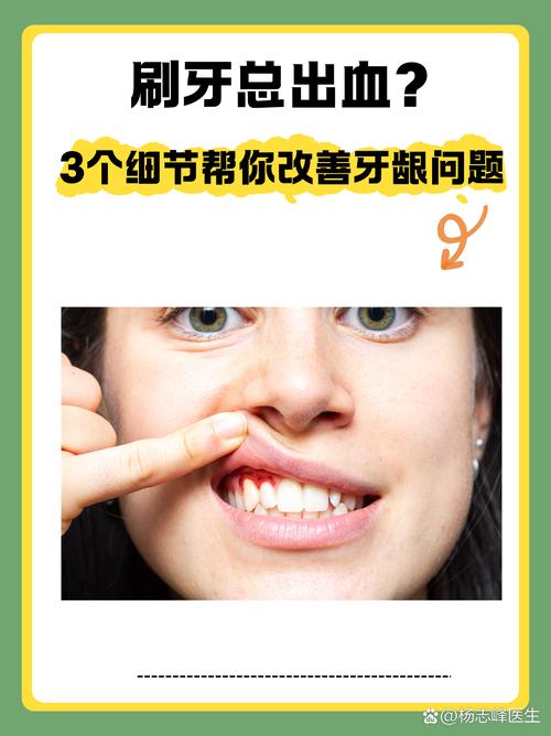 改对刷牙手法，一半出血都能消