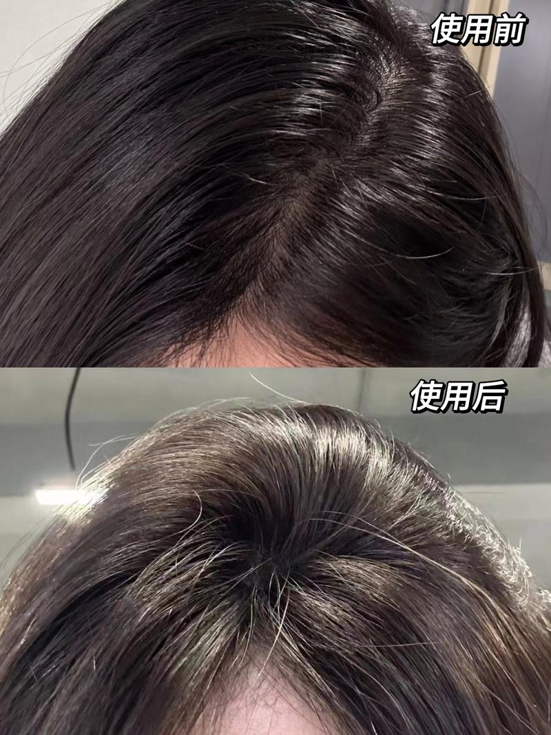 不同头皮出油状态日常对比图