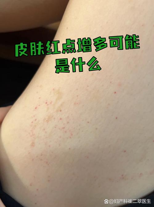 售后和运费，最容易忽视的出血点