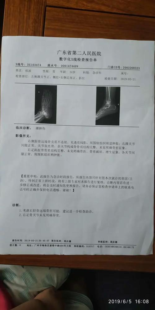 装复复位的标准参数，记好别错