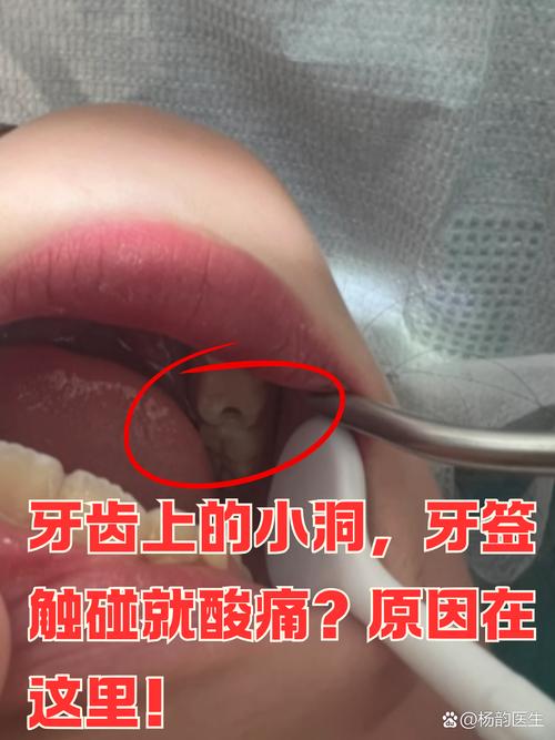 去年踩过的大坑，到现在说起来都牙疼