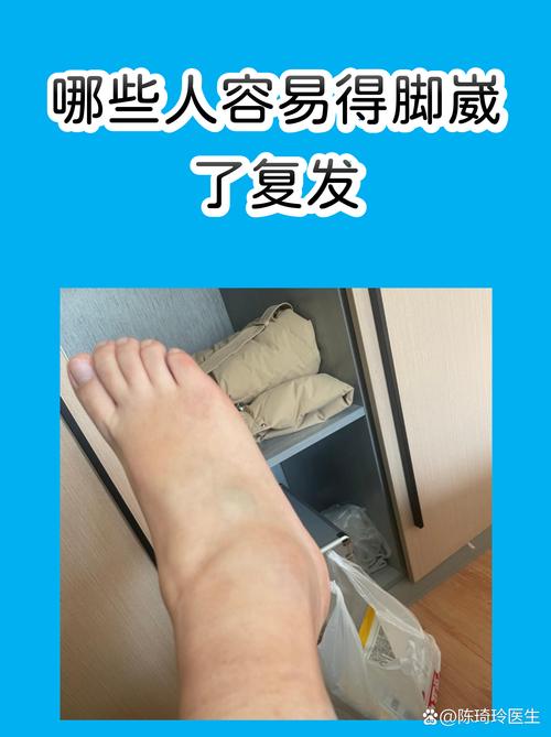 真的复发了，别瞎慌先记要点