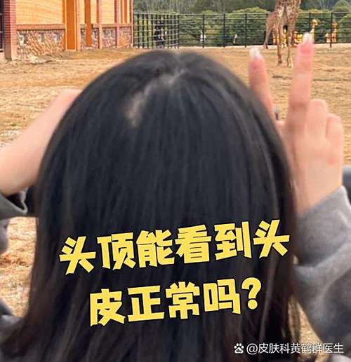 落在普通人头上的真变化