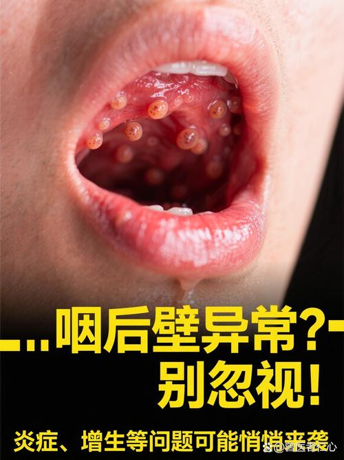 让喉咙彻底“旁观”