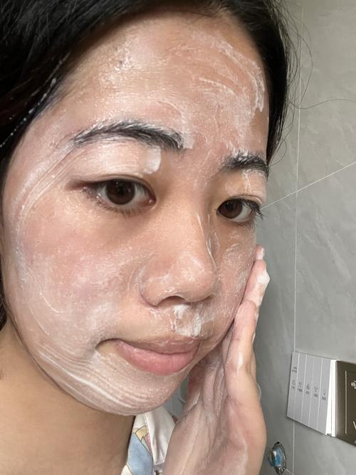 擦脸之前先想：这些情况真不是饮食的锅