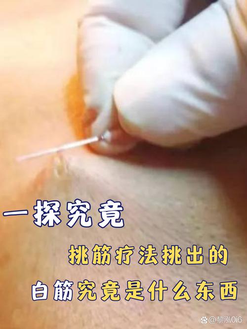 挑的时候盯紧这几个地方