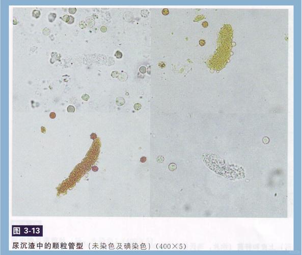 狗狗尿沉渣显微镜下白细胞视野实拍图