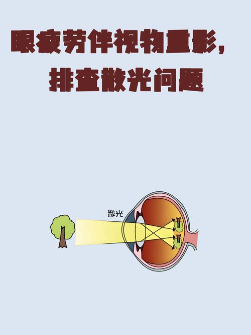 眼睛那点事儿:屏幕盯久了,世界都带重影