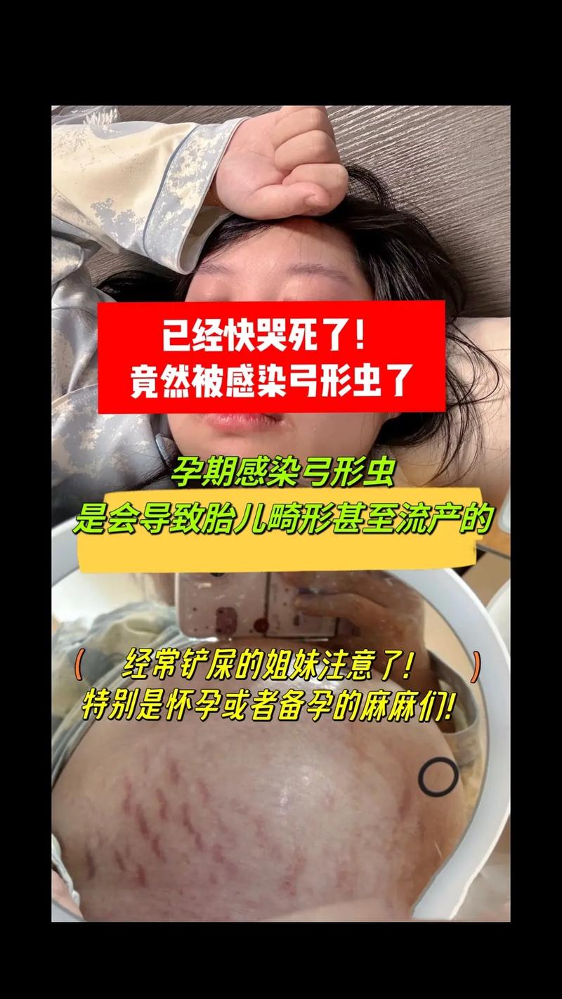 那寄生虫呢?弓形虫真的没那么容易中招