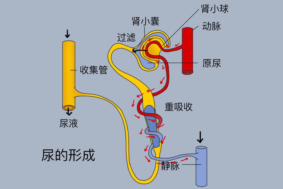 肾脏尿液浓缩结石形成示意图